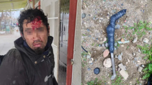 Otro violento episodio en Centenario: un hombre fue atacado con un fierro y terminó en el hospital 